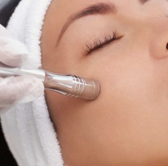 Microdermabrasion - Add On