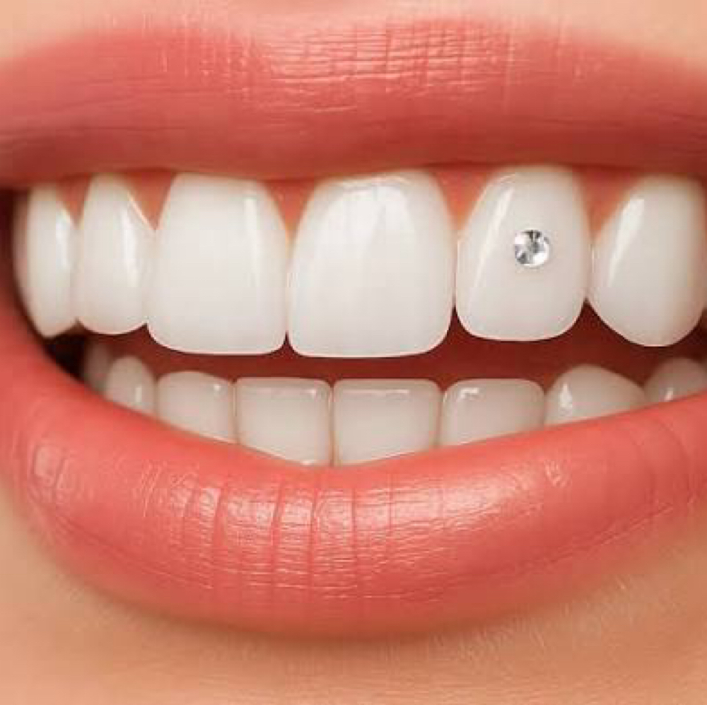 Tooth Gems at JLC Skin Co LLC in San Tan Valley, AZ