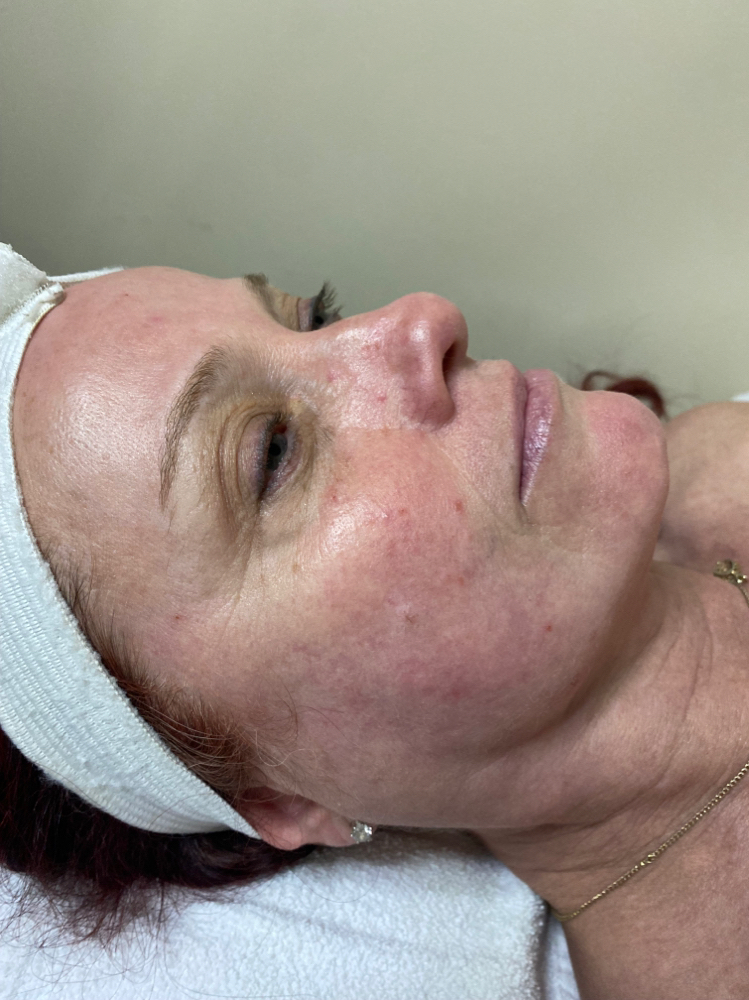 Anti-Aging Facial