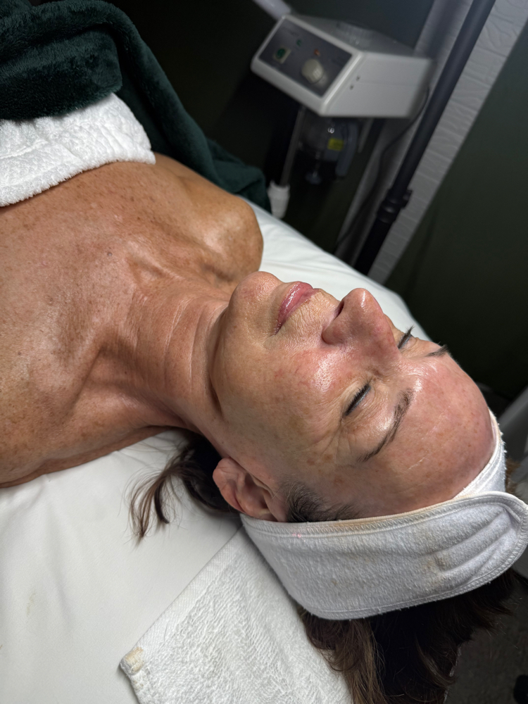 Facelift Facial