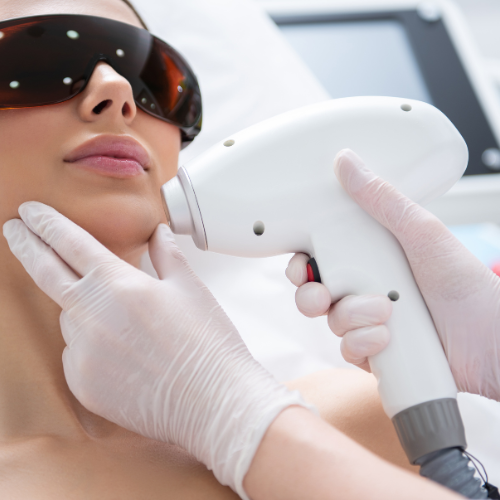Laser Hair Removal - Small Area