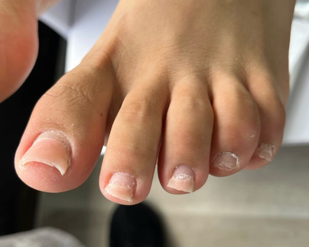 Acrylic Pedicure Fill