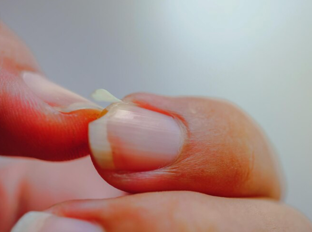 Nail Repair