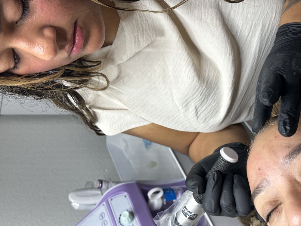 Procell Microchanneling Treatment