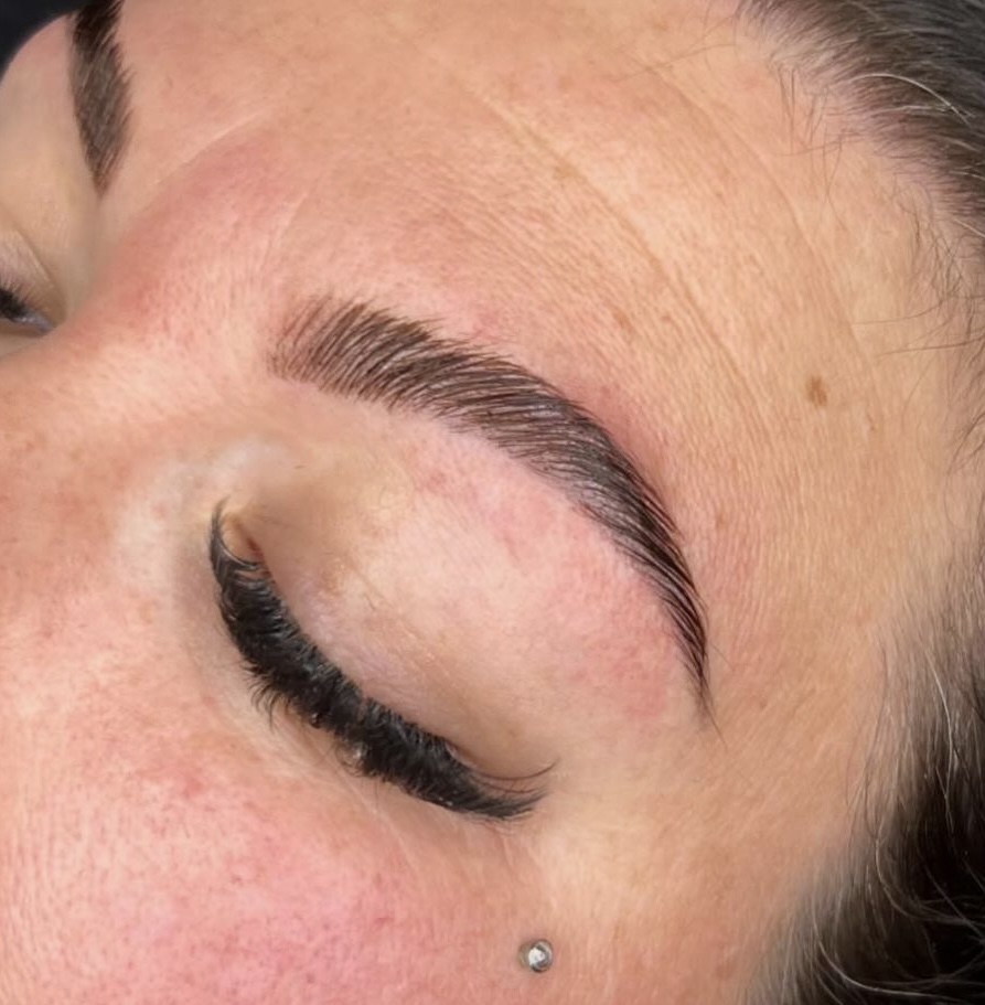 Brow Transformation