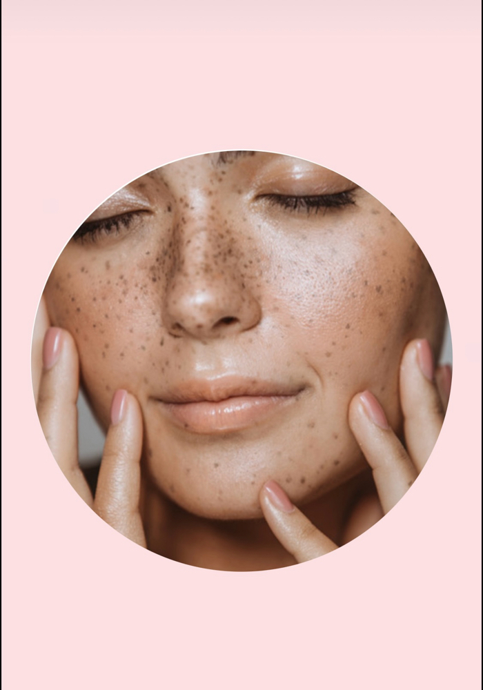 Microdermabrasion