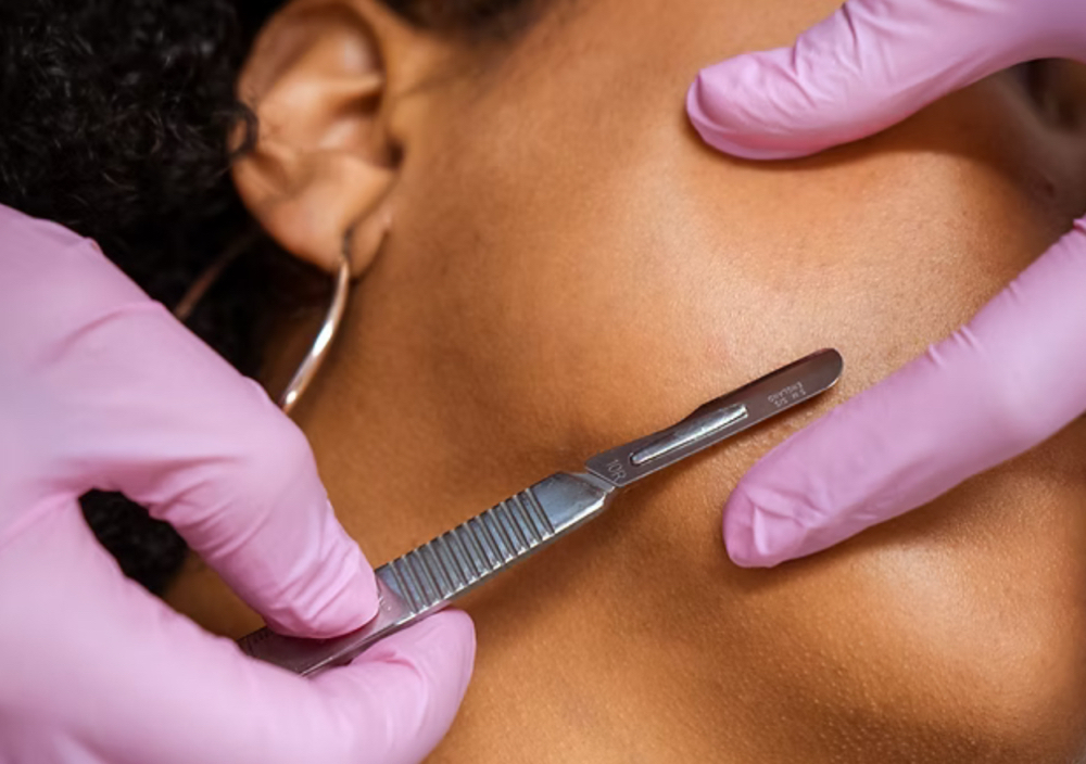 Dermaplane at Simply Skin by Jess in Bryan, TX