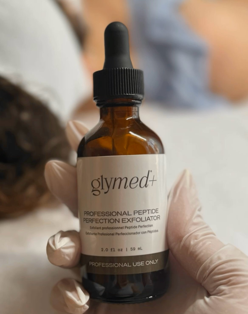 Chemical Peel at Kathy's Skinbar in Fort Payne, AL