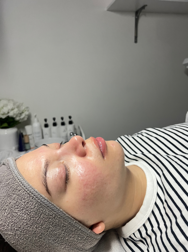 Custom Express Facial w/ LED