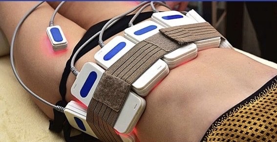 Laser Lipo