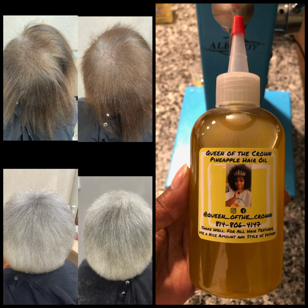 Hair Growth Treatment and Oil at Queen Of The Crown in Charlotte, NC