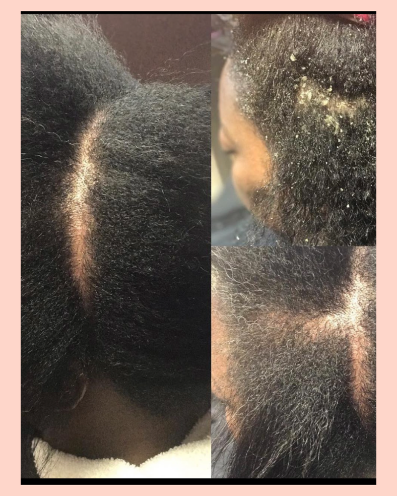 Add On - Scalp Therapy