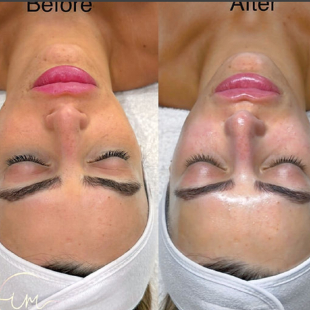 Korean Glass Skin Facial at Esthetics With Michaela in Vidalia, LA
