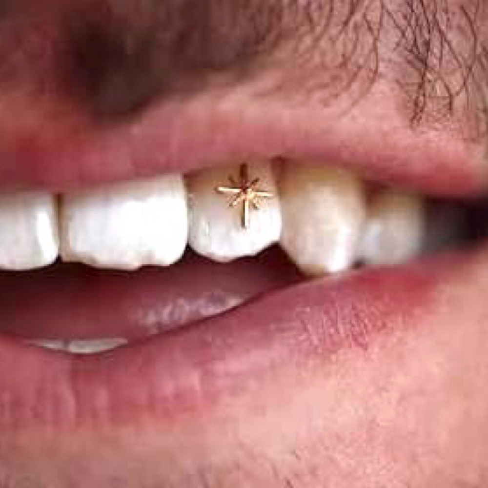 Luxury Design Or Gold Charm at Enthused Smiles in Montclair, NJ