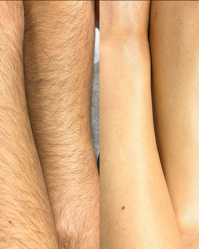 Arm Wax