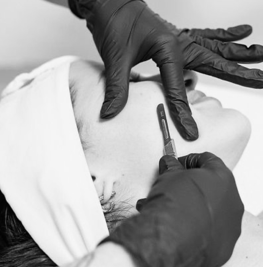 Exfoliation Facial