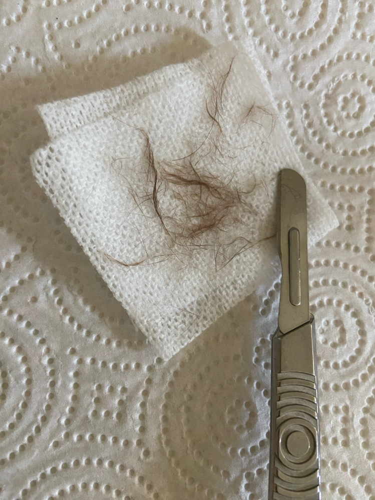 Dermaplane Add On