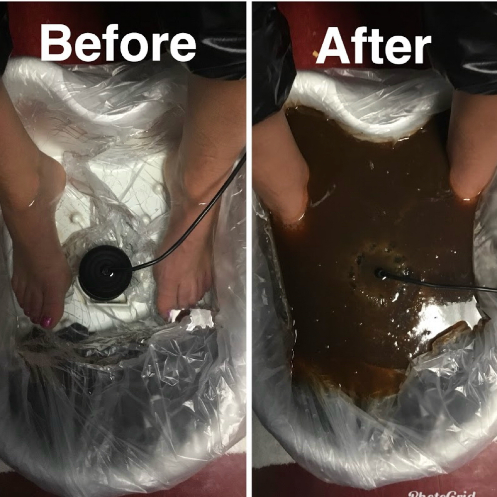 Foot detox at Sister2Sister Wellness Spa in Mesquite, TX
