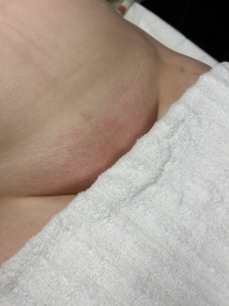 Brazilian Wax
