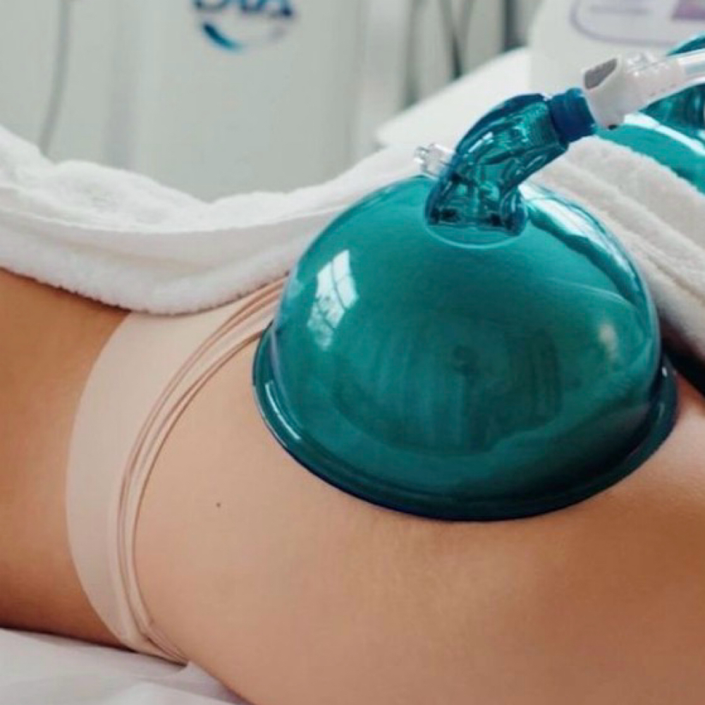 🍑Non invasive BBL