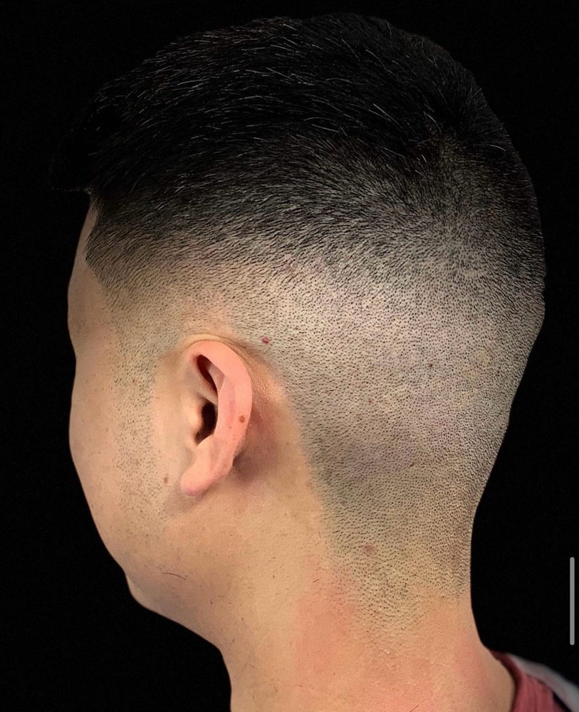 Bald fade