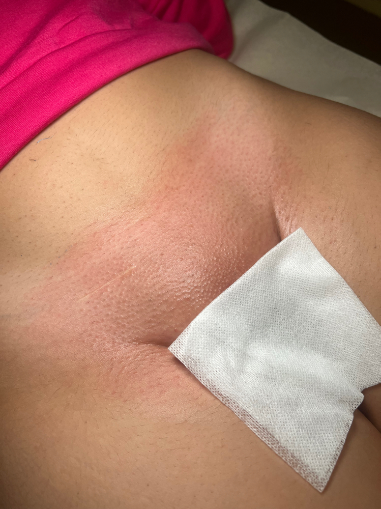 Brazilian- Return at Golden Vanity Aesthetics in Riverside, CA