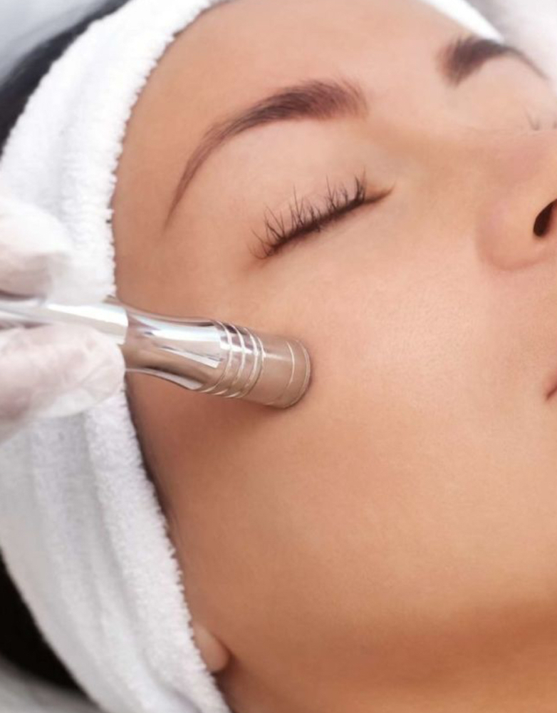 Microdermabrasion Facial