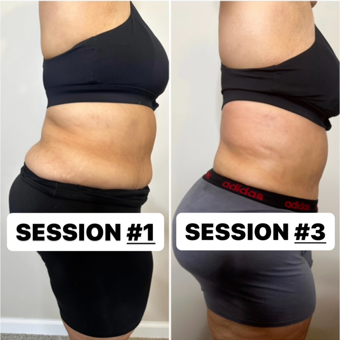 Body Sculpting (4 Sessions) at Beauty Mafia + Wellness in Manassas, VA