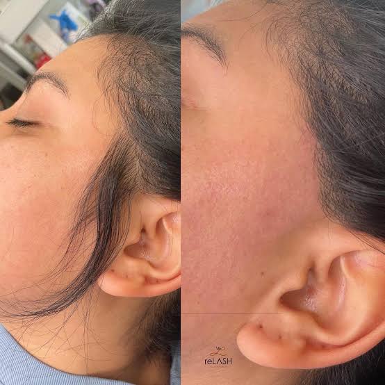 Side Burn Wax at Skin Haven in New Lexington, OH