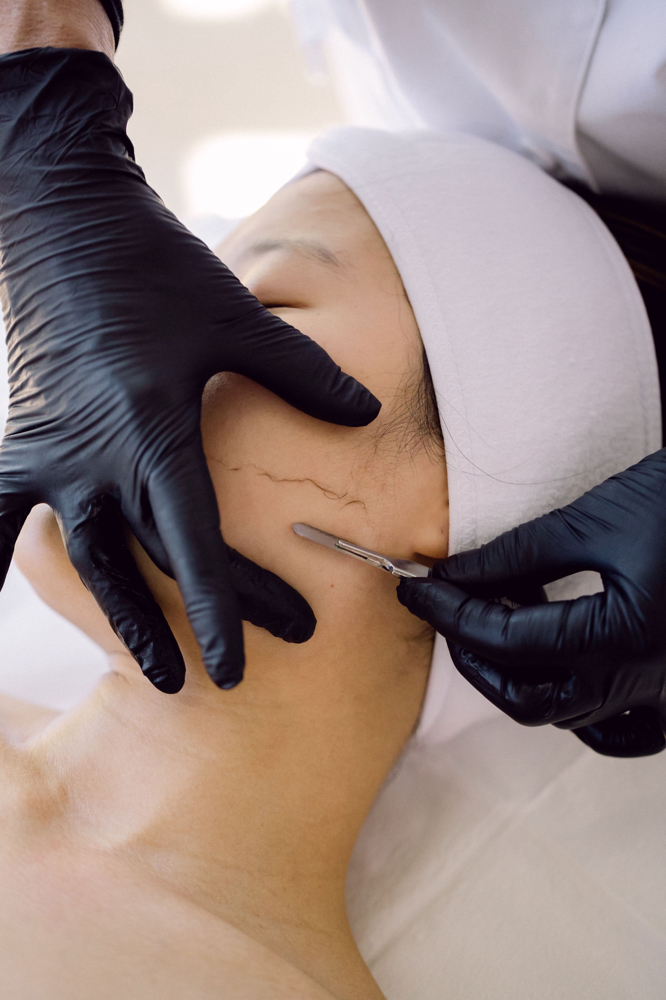 Dermaplane Treatment