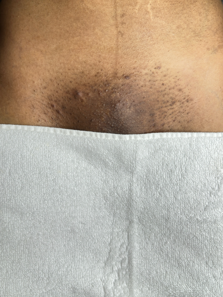 After Wax Vajacial