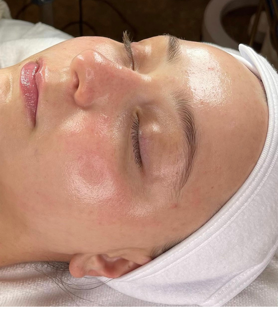 Antiaging Facial & Chemical Peel