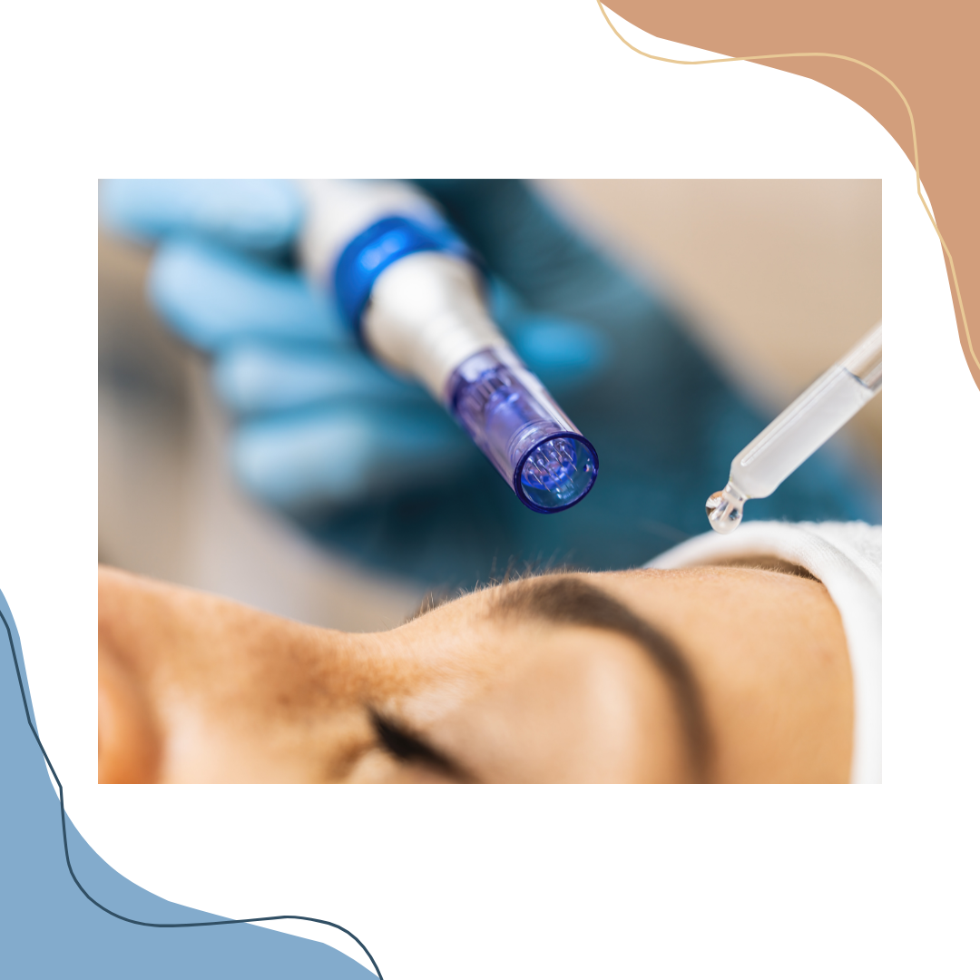 Microneedling at Skin Savvy Spokane in Spokane, WA