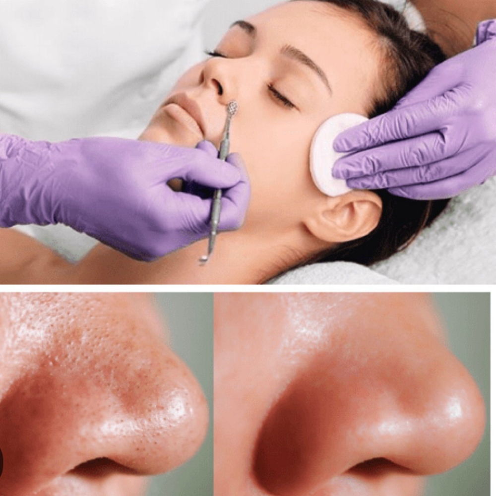 Deep-Clean Facial at Skin Care by Luisa in Missouri City, TX
