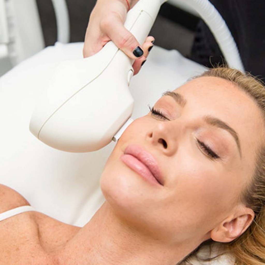 Photo Facial