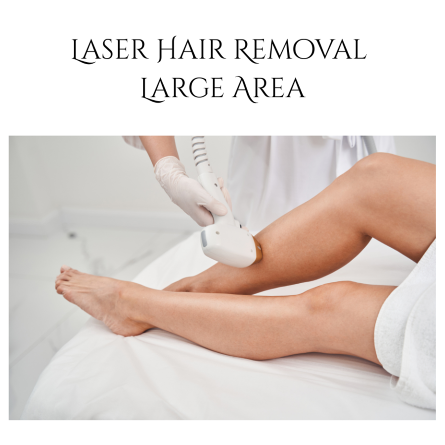 Express Large Area Laser