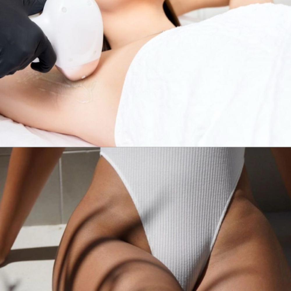 Underarms+Bikini (6 Sessions Each) at Amber Beauty Studio in Miami, FL