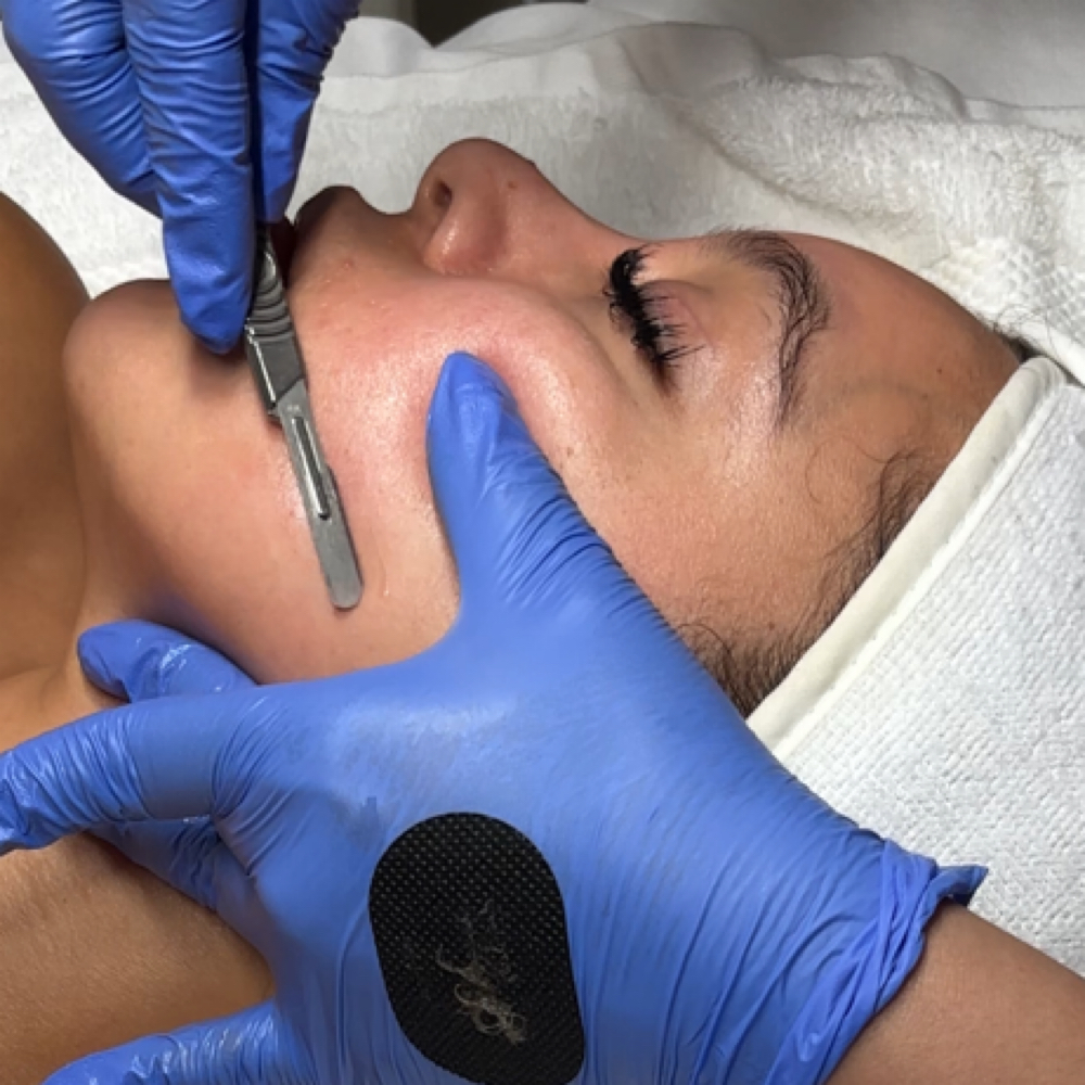 Custom Facial at Linda Piel in San Antonio, TX