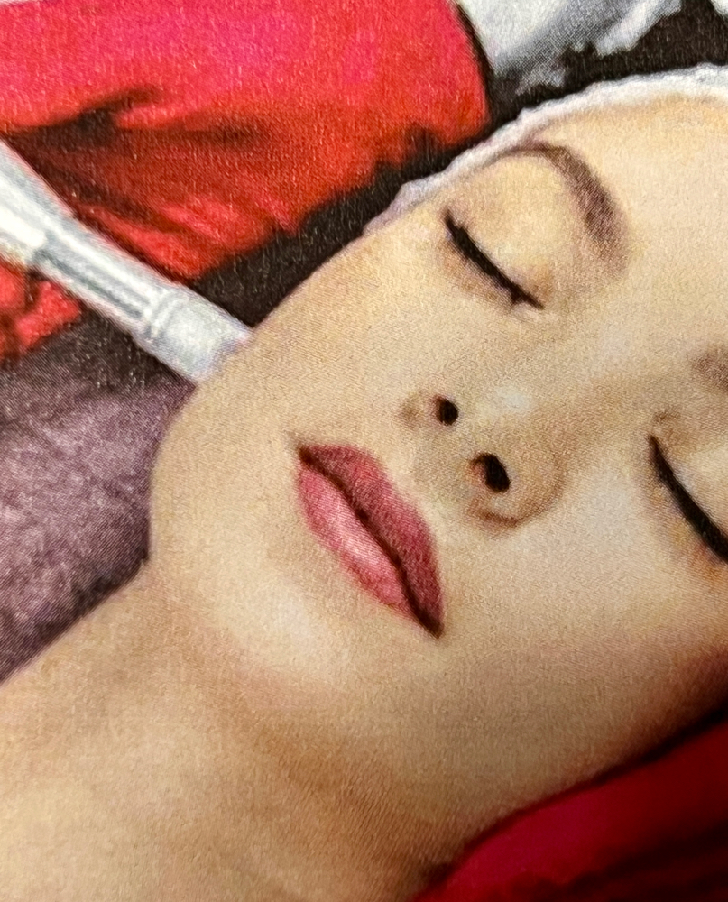 Microneedling at AZOL BEAUTY in Phoenix, AZ