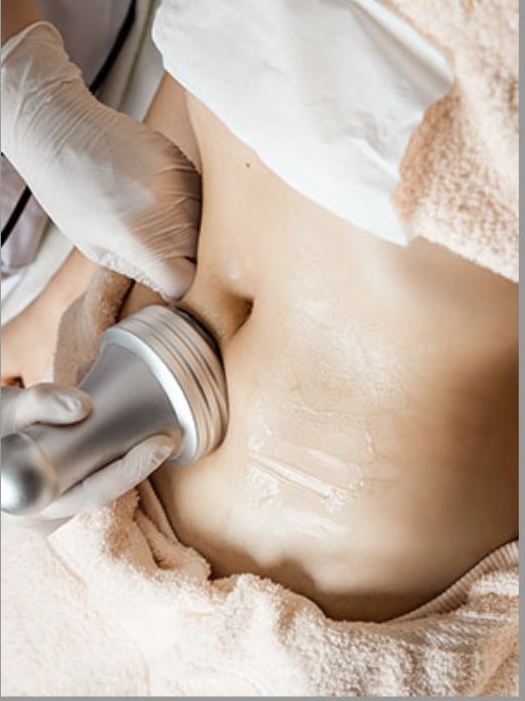 Ultrasonic Body Contouring