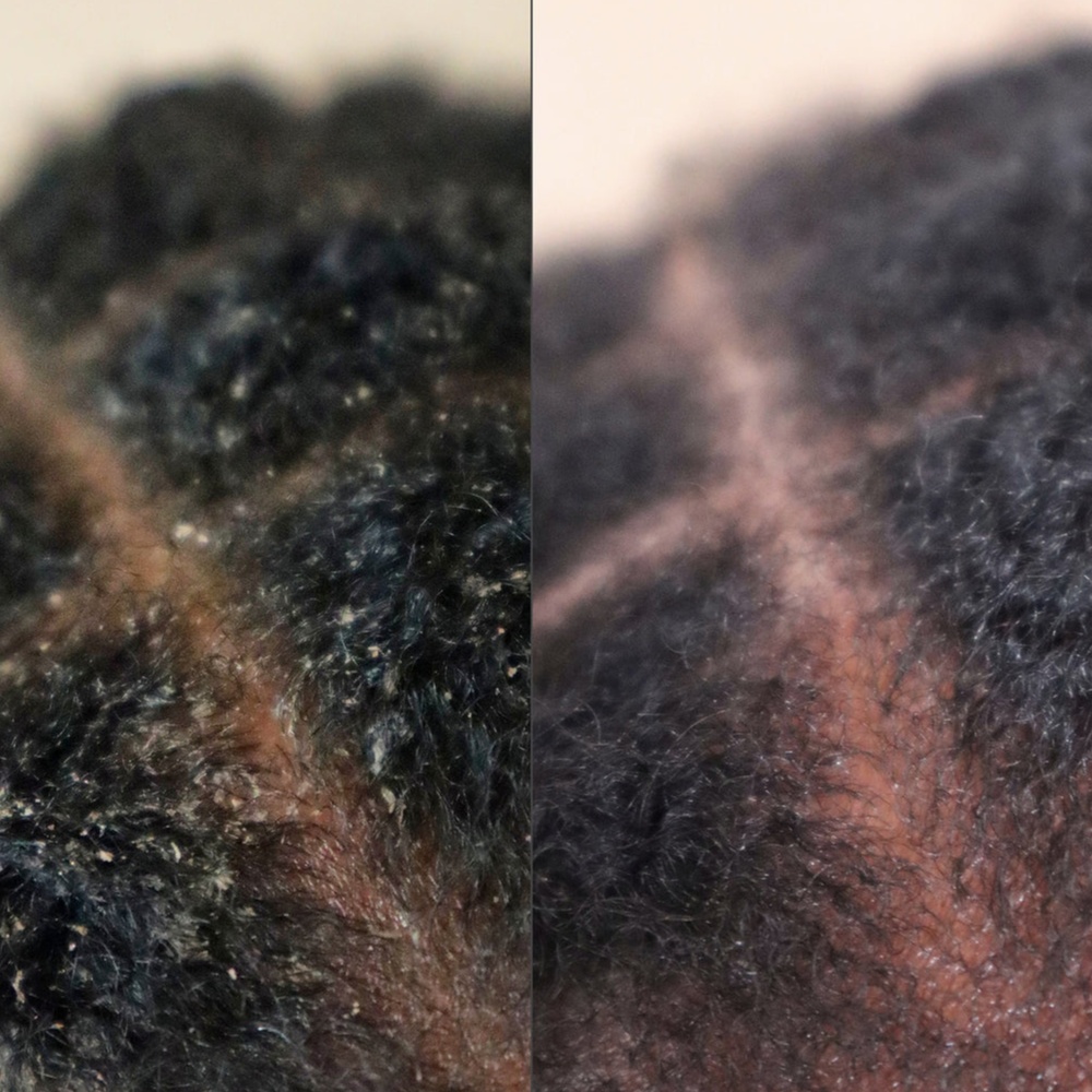 Scalp detox treatment at Yanique's Beauty Bar in Everett, MA