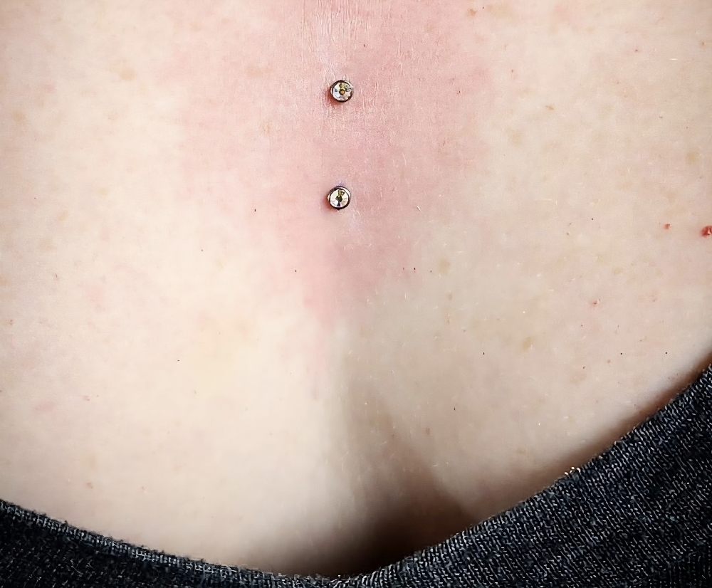 Dermal(noface)