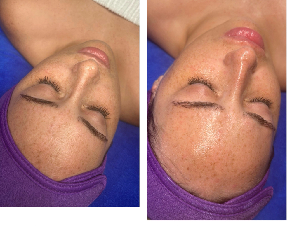 Vitamin C Glow Facial