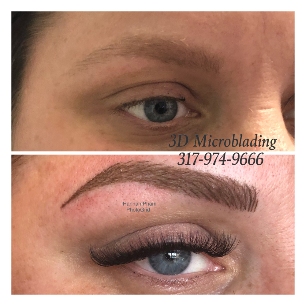 Touch Up 4-6 Weeks (1st)