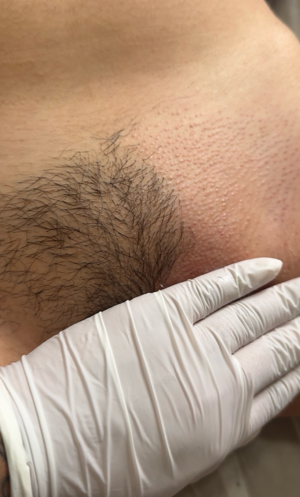 Brazilian Wax