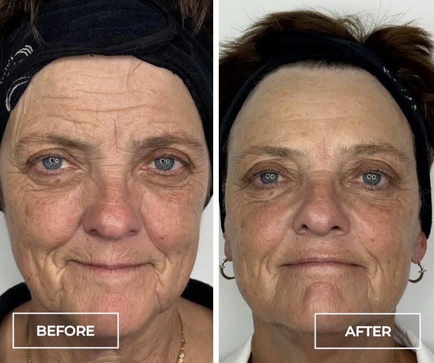 2 Week Follow Up