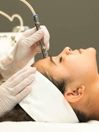 Microdermabrasion Add On