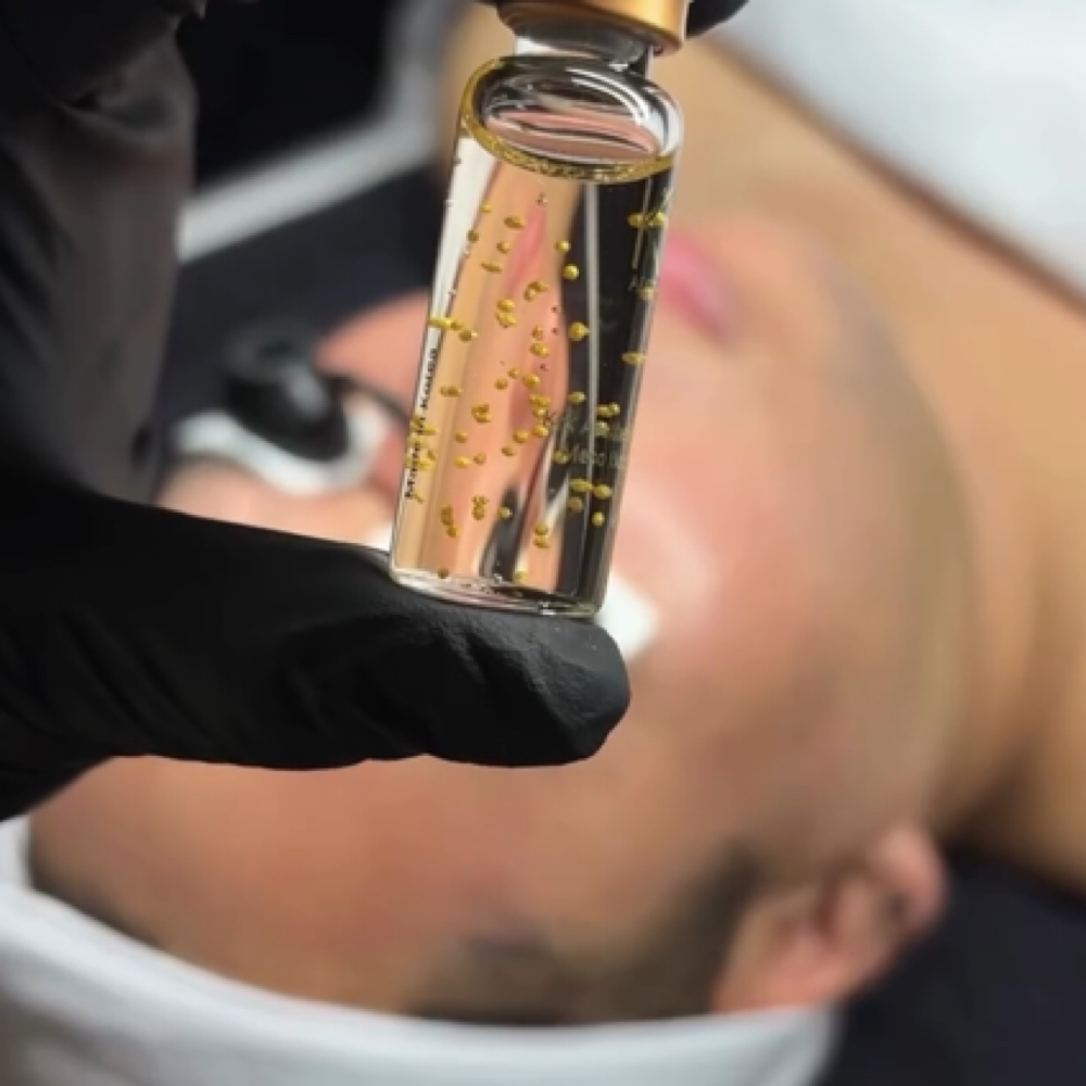 Microneedling with Salmon DNA