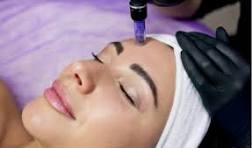 Micro Needling