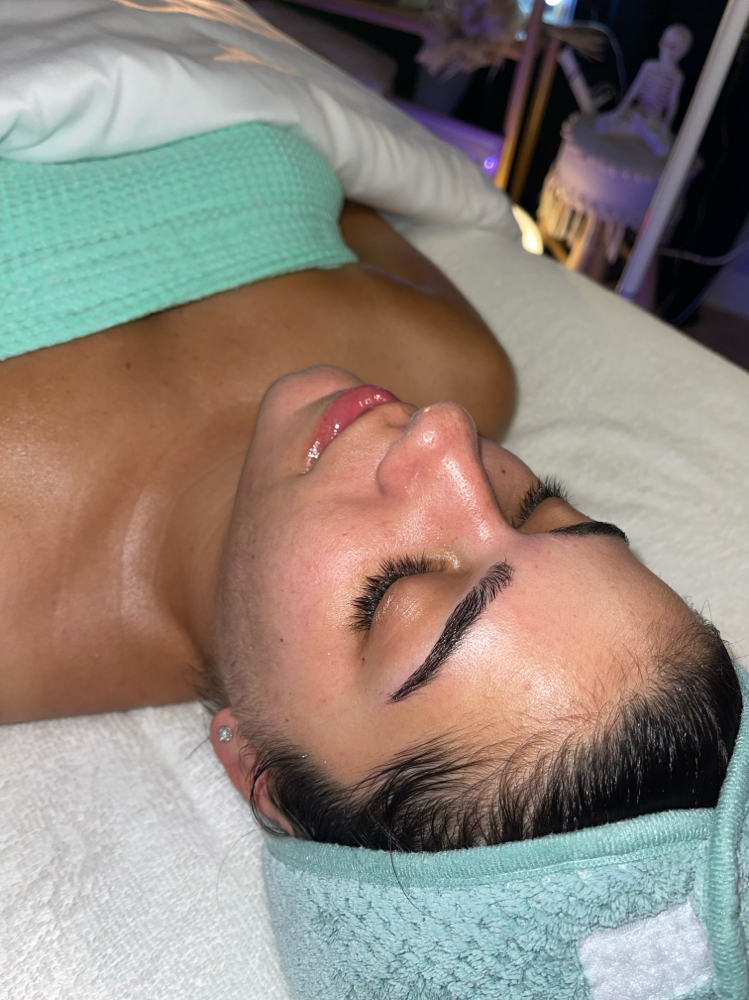 Microdermabrasion Facial